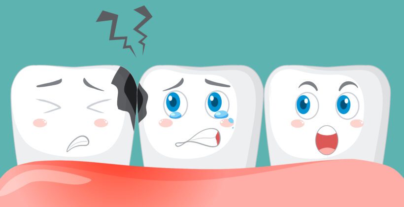 Cracked and Broken Teeth: Causes, Treatments, and Restorative Solutions