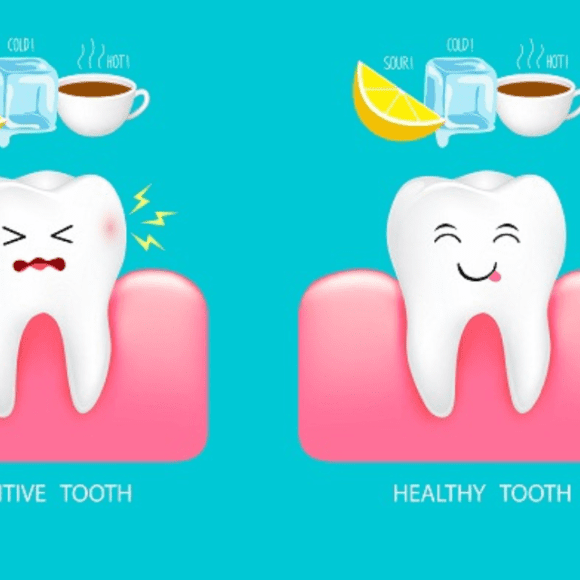 Decoding Tooth Sensitivity: Causes, Treatments, and Prevention