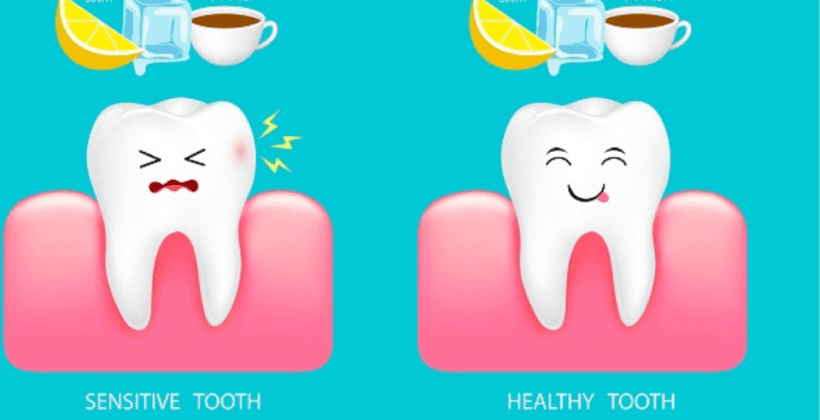 Decoding Tooth Sensitivity: Causes, Treatments, and Prevention