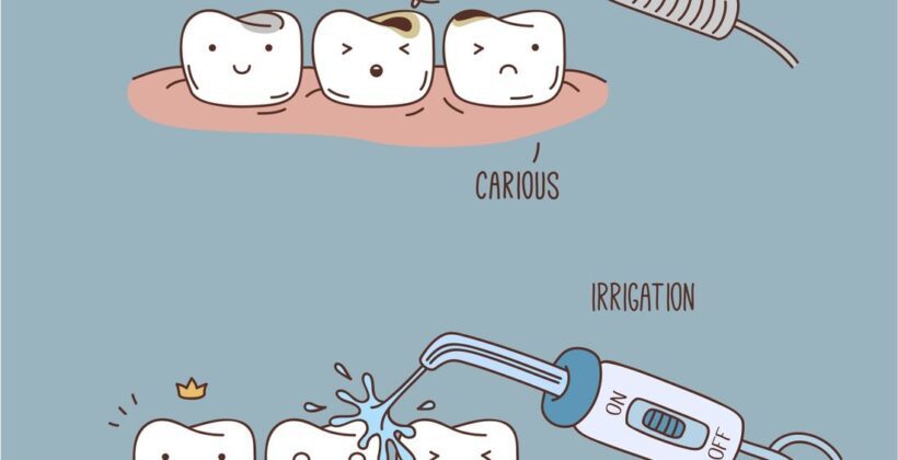 Optimizing Oral Health: The Impact and Effectiveness of Dental Fillings