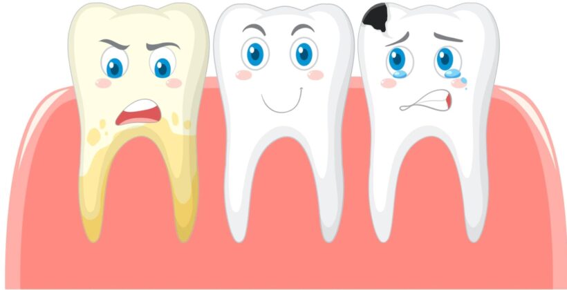 The Science Behind Tooth Decay: Exploring Causes and Cures