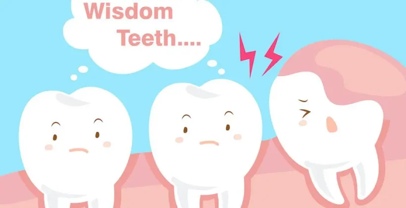 Wisdom Teeth Removal: What to Expect and How to Prepare