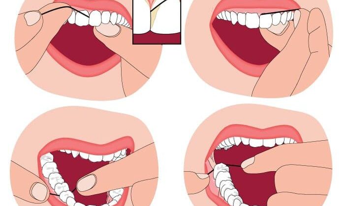 The Flossing Revolution: Breakthrough Techniques You Need to Try Today