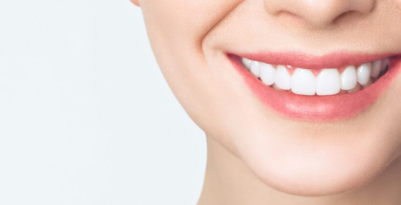 “Expert Tips for Maintaining a Bright White Smile”