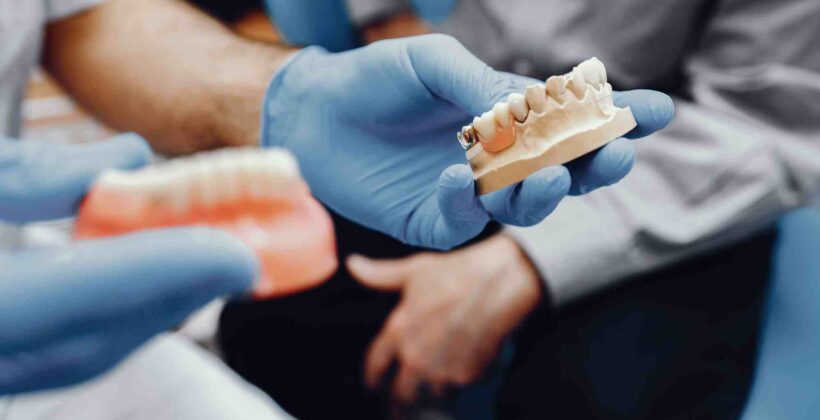 How Long Do Dental Crowns Last? A Guide from Krishees Dental How Long Do Dental Crowns Last? A Guide from Krishees Dental